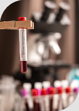 Blood Testing